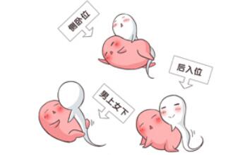 ι(xing)X