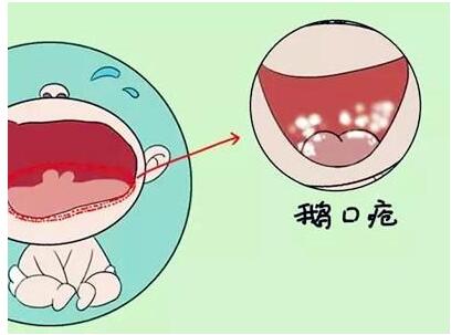 Zگô