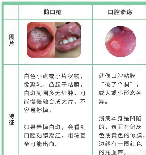 3(g)(x)TTl(f)Zگٲ